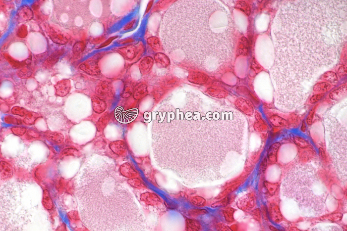 Glande mammaire x200 - gryphea.org